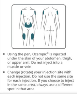 chart showing injection sites on the body